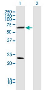 CLU Monoclonal Antibody (1A11)