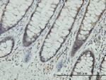 CLIC1 Antibody in Immunohistochemistry (Paraffin) (IHC (P))