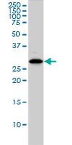 CLIC1 Antibody in Western Blot (WB)