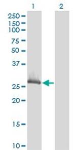 CLIC1 Antibody in Western Blot (WB)