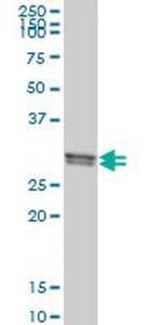 CLIC1 Antibody in Western Blot (WB)