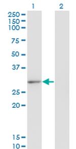 CLIC2 Monoclonal Antibody (2C1)