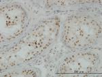 CLK3 Antibody in Immunohistochemistry (Paraffin) (IHC (P))
