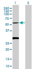 CLN3 Polyclonal Antibody, MaxPab™