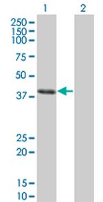 CLN3 Monoclonal Antibody (1G10)
