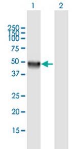 CLN5 Antibody in Western Blot (WB)