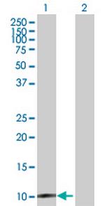 CLPS Antibody in Western Blot (WB)