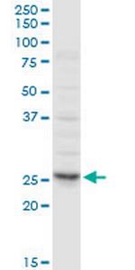 CLTA Polyclonal Antibody, MaxPab™