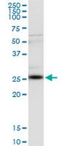 CLTA Monoclonal Antibody (4E9)