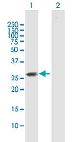 CLTB Polyclonal Antibody, MaxPab™
