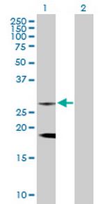 CLTB Polyclonal Antibody, MaxPab™