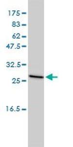 CLTB Antibody in Western Blot (WB)