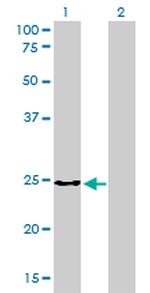 CLTB Antibody in Western Blot (WB)