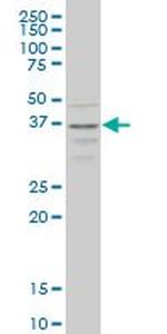 CCR2 Monoclonal Antibody (4D12)