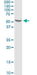 CCR5 Antibody in Western Blot (WB)