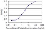 CNN1 Antibody in ELISA (ELISA)