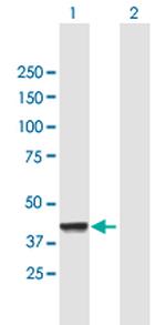 CNP Polyclonal Antibody, MaxPab™