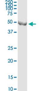 CNP Antibody in Western Blot (WB)