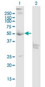 CNR1 Polyclonal Antibody, MaxPab™