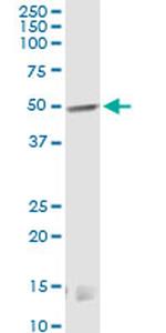 CNR1 Monoclonal Antibody (2F9)