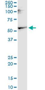 CNR1 Monoclonal Antibody (1F9)