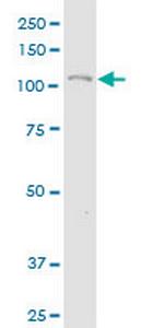 COL19A1 Antibody in Western Blot (WB)