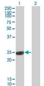 COMT Monoclonal Antibody (1G4-1A1)