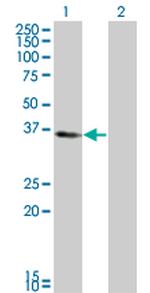 KLF6 Antibody in Western Blot (WB)