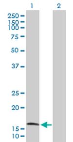 COX4I1 Antibody in Western Blot (WB)