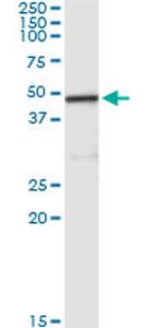 CPA2 Antibody in Immunoprecipitation (IP)
