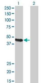 CPA2 Monoclonal Antibody (2E11)