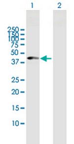 CPB1 Polyclonal Antibody, MaxPab™