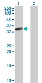 CPB1 Polyclonal Antibody, MaxPab™