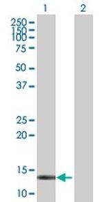 CRABP2 Antibody in Western Blot (WB)