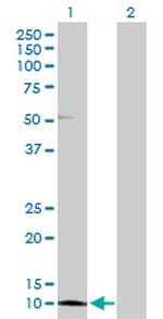 CRABP2 Antibody in Western Blot (WB)