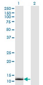 CRABP2 Antibody in Western Blot (WB)