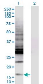 CREBL2 Antibody in Western Blot (WB)