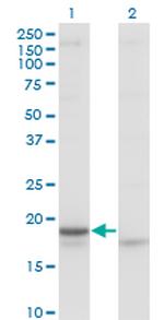 CRH Monoclonal Antibody (2B11)