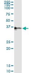 CRHBP Monoclonal Antibody (3D9)