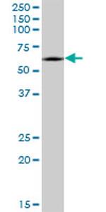 CRMP1 Monoclonal Antibody (2B6)