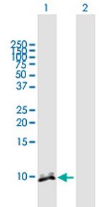 CRP Polyclonal Antibody, MaxPab™