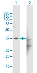 HAPLN1 Polyclonal Antibody, MaxPab™