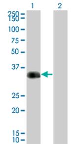 CRX Antibody in Western Blot (WB)