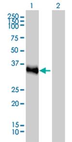 CRX Monoclonal Antibody (4G11)