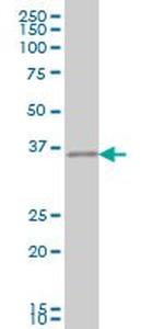CRX Antibody in Western Blot (WB)