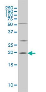 CRYAB Antibody in Western Blot (WB)