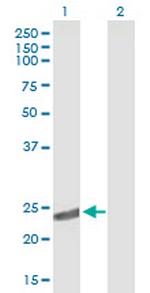CRYBA2 Polyclonal Antibody, MaxPab™