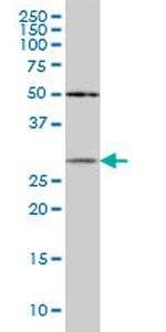 CRYBB1 Antibody in Western Blot (WB)