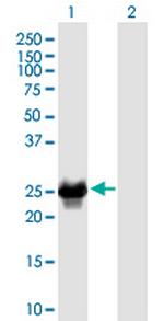CRYBB2 Monoclonal Antibody (1F1)
