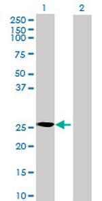 CRYBB3 Polyclonal Antibody, MaxPab™